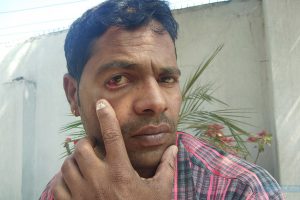 न्याय माग्न जाँदा गाउँपालिका अध्यक्षबाटै सेवाग्राही कुटाई खाएर अस्पताल भर्ना