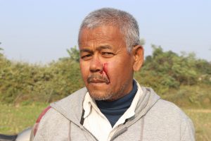 उदयपुरमा जग्गा विवादमा पत्रकार रविन्द्र चौधरीमाथि कुटपिट